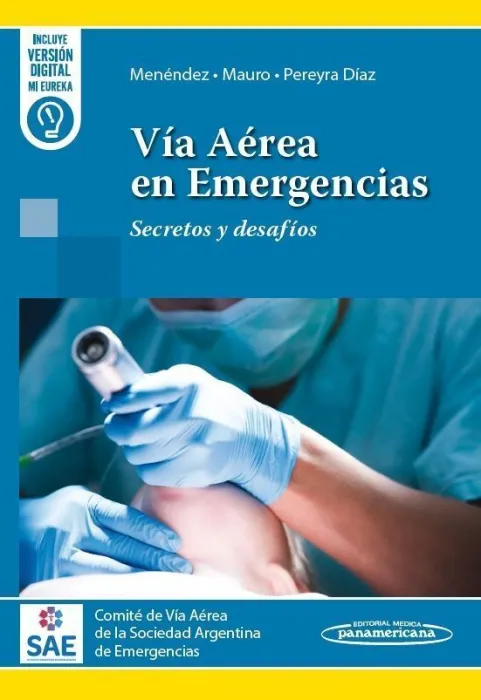 Via Aerea en Emergencias: Secretos y Desafios